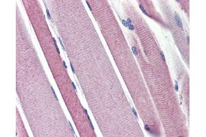 Hexokinase 2 antibody was used for immunohistochemistry at a concentration of 4-8 ug/ml. (Hexokinase 2 抗体  (N-Term))