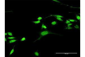 Immunofluorescence of purified MaxPab antibody to RASGRP3 on HeLa cell. (RASGRP3 抗体  (AA 1-690))