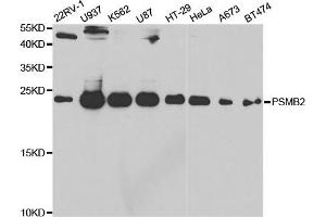 Western Blotting (WB) image for anti-Proteasome (Prosome, Macropain) Subunit, beta Type 2 (PSMB2) antibody (ABIN1876671) (PSMB2 抗体)