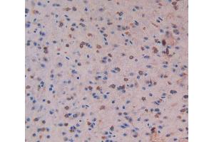 IHC-P analysis of Liver tissue, with DAB staining. (MST1 抗体  (AA 469-704))