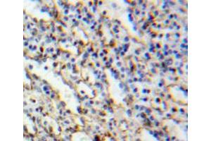 Used in DAB staining on fromalin fixed paraffin-embedded spleen tissue (MYO1G 抗体  (AA 754-1018))