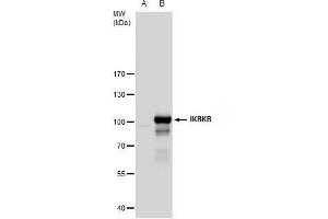 WB Image IKK beta antibody detects IKK beta protein by western blot analysis. (IKBKB 抗体  (C-Term))