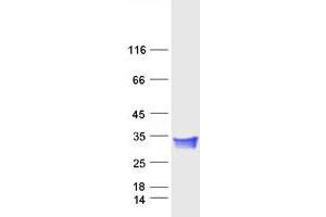 Western Blotting (WB) image for Collagen Triple Helix Repeat Containing 1 (CTHRC1) protein (Myc-DYKDDDDK Tag) (ABIN2712611)