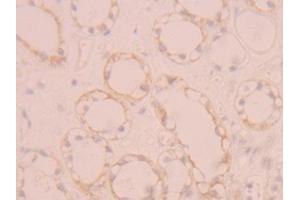 Detection of FGFR1 in Human Kidney Tissue using Polyclonal Antibody to Fibroblast Growth Factor Receptor 1 (FGFR1) (FGFR1 抗体  (AA 236-362))