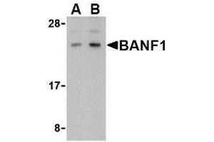 Western blot analysis of BANF1 in human kidney tissue lysate with AP30118PU-N BANF1 antibody at (A) 0. (BANF1 抗体  (C-Term))