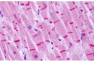 Anti-GRM8 / MGLUR8 antibody IHC staining of human heart. (GRM8 抗体  (N-Term))