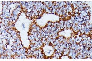 Immunohistochemistry (Paraffin-embedded Sections) (IHC (p)) image for anti-Isocitrate Dehydrogenase 3 (NAD+) alpha (IDH3A) antibody (ABIN7258018)