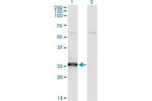 Western Blot analysis of TK1 expression in transfected 293T cell line by TK1 monoclonal antibody (M04), clone 1D10. (TK1 抗体  (AA 1-234))