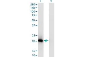 Western Blot analysis of VSTM2L expression in transfected 293T cell line by C20orf102 monoclonal antibody (M02), clone 1A8. (VSTM2L 抗体  (AA 25-204))