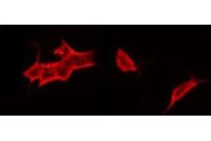 Immunofluorescence (fixed cells) (IF/ICC) image for anti-Corticotropin Releasing Hormone Receptor 1 (CRHR1) (Internal Region) antibody (ABIN6261033)