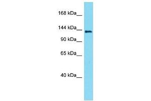 Western Blotting (WB) image for anti-Lemur Tyrosine Kinase 3 (LMTK3) (Middle Region) antibody (ABIN2790811) (LMTK3 抗体  (Middle Region))