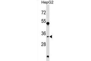 Western Blotting (WB) image for anti-Spermidine Synthase (SRM) antibody (ABIN2999104) (Spermidine Synthase 抗体)