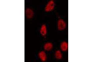 ABIN6274352 staining HepG2 cells by IF/ICC. (E2F2 抗体  (Internal Region))