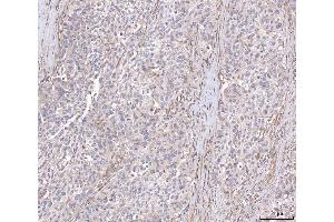 IHC analysis of ANGPT2 using anti-ANGPT2 antibody (ABIN3043725). (Angiopoietin 2 抗体  (AA 19-348))