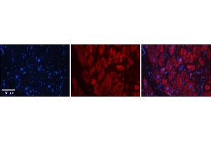 Rabbit Anti-SIX1 Antibody    Formalin Fixed Paraffin Embedded Tissue: Human Adult heart  Observed Staining: Cytoplasmic,Nuclear Primary Antibody Concentration: 1:600 Secondary Antibody: Donkey anti-Rabbit-Cy2/3 Secondary Antibody Concentration: 1:200 Magnification: 20X Exposure Time: 0. (SIX Homeobox 1 抗体  (Middle Region))