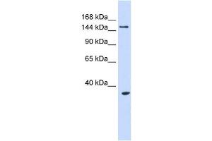 UBE3B antibody used at 1 ug/ml to detect target protein.