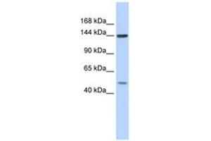 Image no. 1 for anti-Splicing Factor 3b, Subunit 1, 155kDa (SF3B1) (AA 287-336) antibody (ABIN6743003) (SF3B1 抗体  (AA 287-336))