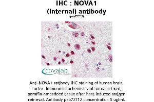 Image no. 1 for anti-Neuro-Oncological Ventral Antigen 1 (NOVA1) (Internal Region) antibody (ABIN1737442) (NOVA1 抗体  (Internal Region))