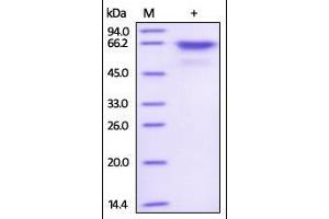 SDS-PAGE (SDS) image for V-Akt Murine Thymoma Viral Oncogene Homolog 1 (AKT1) (AA 1-480) protein (His tag,Strep Tag) (ABIN2180576)