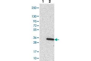 Western blot analysis of Lane 1: Negative control (vector only transfected HEK293T lysate). (LRRC18 抗体)