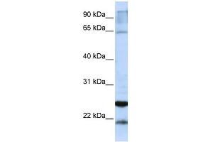 GSTA4 antibody used at 1 ug/ml to detect target protein. (GSTA4 抗体  (C-Term))