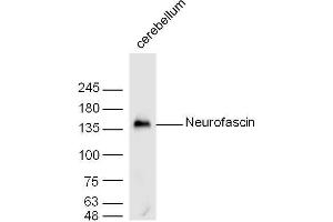 Mouse cerebellum lysates probed with Neurofascin Polyclonal Antibody, unconjugated  at 1:300 overnight at 4°C followed by a conjugated secondary antibody at 1:10000 for 60 minutes at 37°C. (NFASC 抗体  (AA 501-650))