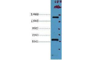 Western Blotting (WB) image for anti-Protein tyrosine Phosphatase, Receptor Type, C (PTPRC) antibody (ABIN3181116) (CD45 抗体)