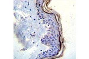c-Kit antibody immunohistochemistry analysis in formalin fixed and paraffin embedded human skin tissue. (KIT 抗体  (AA 106-135))