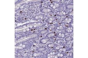 Immunohistochemical staining of human duodenum with IL17REL polyclonal antibody  shows selective positivity in a subset of leukocytes at 1:50-1:200 dilution. (IL17REL 抗体)