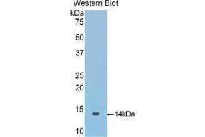 Detection of Recombinant SNCa, Mouse using Polyclonal Antibody to Synuclein Alpha (SNCa) (SNCA 抗体  (AA 23-140))