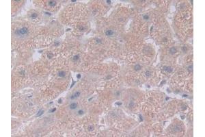 Detection of NOTCH4 in Human Liver Tissue using Polyclonal Antibody to Notch Homolog 4 (NOTCH4) (NOTCH4 抗体  (AA 1715-2001))