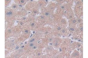 Detection of NOTCH4 in Human Liver Tissue using Polyclonal Antibody to Notch Homolog 4 (NOTCH4) (NOTCH4 抗体  (AA 1715-2001))