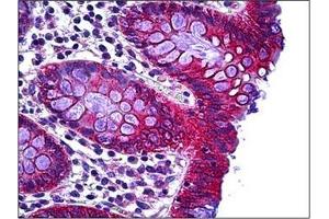 Human Colon: Formalin-Fixed, Paraffin-Embedded (FFPE) (RHOH 抗体  (C-Term))