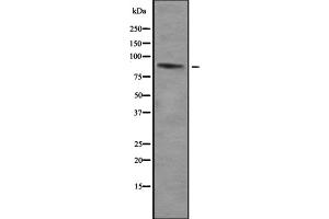 Western blot analysis of ZNF785 using HepG2 whole cell lysates (ZNF785 抗体)