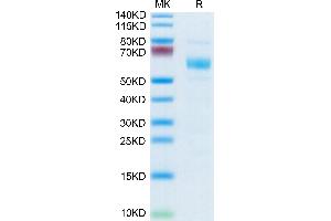 Human APCDD1 on Tris-Bis PAGE under reduced condition. (APCDD1 Protein (AA 27-492) (APC,His tag))