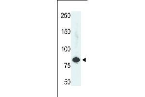 The anti-PFKL Pab (ABIN392745 and ABIN2842201) is used in Western blot to detect PFKL in HepG2 cell lysate. (PFKL 抗体  (C-Term))