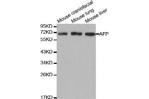 alpha Fetoprotein 抗体  (AA 360-609)