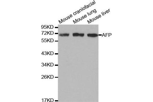 alpha Fetoprotein 抗体  (AA 360-609)