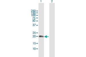 Western Blot analysis of VSTM2L expression in transfected 293T cell line by VSTM2L MaxPab polyclonal antibody. (VSTM2L 抗体  (AA 1-204))