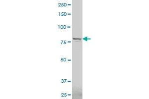 TROAP polyclonal antibody (A01), Lot # 051214JC01 Western Blot analysis of TROAP expression in IMR-32 . (TROAP 抗体  (AA 181-280))