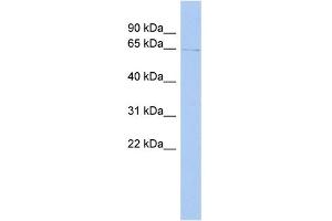 WB Suggested Anti-TIGD1 Antibody Titration: 0. (TIGD1 抗体  (Middle Region))