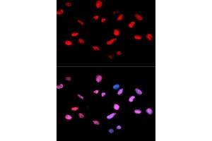 Immunofluorescence analysis of U2OS cells using Phospho-Rb-S811 antibody (ABIN5969933). (Retinoblastoma 1 抗体  (pSer811))