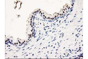 Immunohistochemical staining of paraffin-embedded Human prostate tissue using anti-SMS mouse monoclonal antibody. (SMS 抗体)