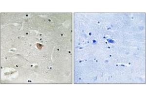Immunohistochemistry analysis of paraffin-embedded human brain, using KIF13B Antibody. (KIF13B 抗体  (AA 111-160))