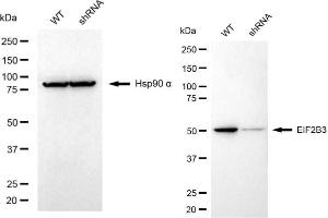 Western blotting analysis using EIF2B3 antibody (ABIN7798514).