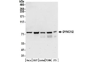 Western Blotting (WB) image for anti-Dynein, Cytoplasmic 1, Intermediate Chain 2 (DYNC1I2) (AA 588-638) antibody (ABIN7455046)