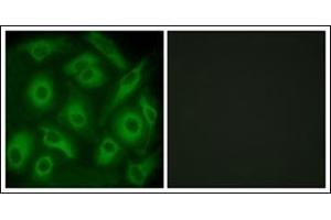 Immunofluorescence analysis of HeLa cells, using CDH23 Antibody. (CDH23 抗体  (N-Term))