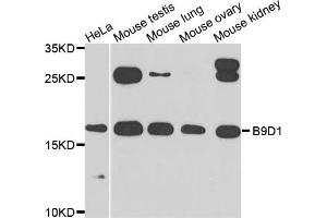 Western blot analysis of extracts of various cells, using B9D1 antibody. (B9D1 抗体)