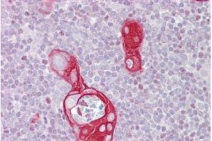 Immunohistochemistry with Thymus tissue at an antibody concentration of 5µg/ml using anti-FAIM antibody (ARP56237_P050) (FAIM 抗体  (N-Term))