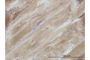 Immunoperoxidase of monoclonal antibody to SH3BGR on formalin-fixed paraffin-embedded human skeletal muscle. (SH3BGR 抗体  (AA 1-239))